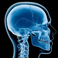 UCSF Craniofacial Center